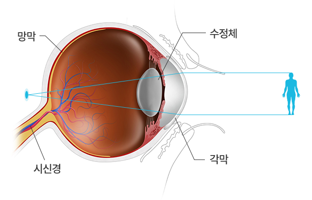 망막, 시신경, 각막, 수정체