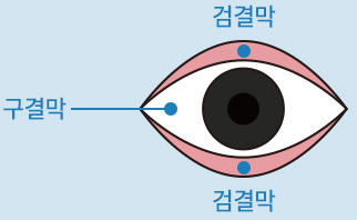 검결막, 구결막, 검결막